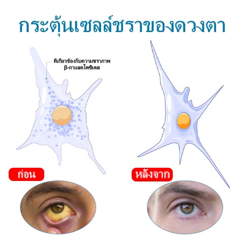 ATTDX Treatment EyeProblems SolutionDrops